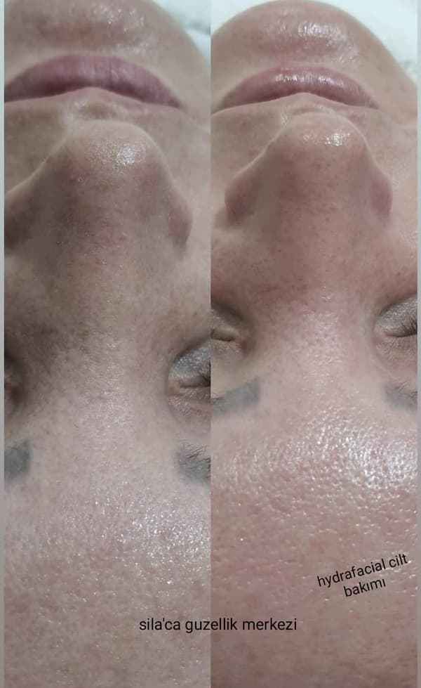 Sıla Zengin Güzellik Salonu - 25. Fotoğraf Sıla Zengin Güzellik Salonu - 25. Fotoğraf