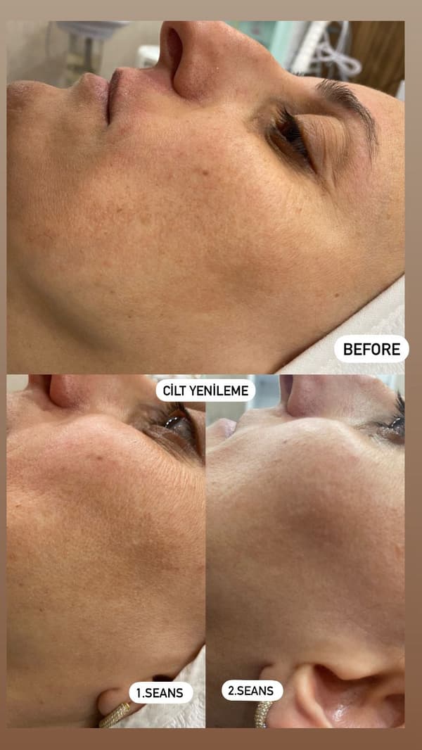 Sıla Zengin Güzellik Salonu - 186. Fotoğraf Sıla Zengin Güzellik Salonu - 186. Fotoğraf