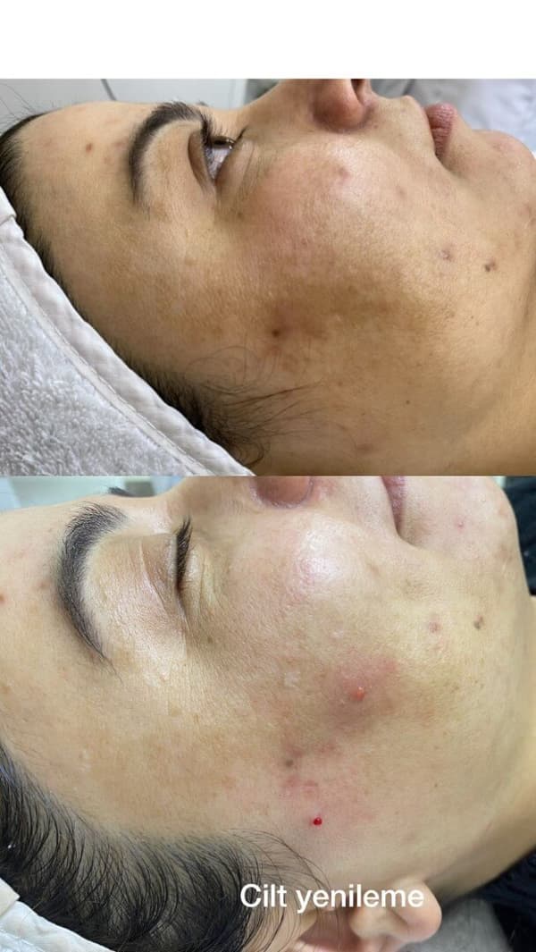 Sıla Zengin Güzellik Salonu - 83. Fotoğraf Sıla Zengin Güzellik Salonu - 83. Fotoğraf