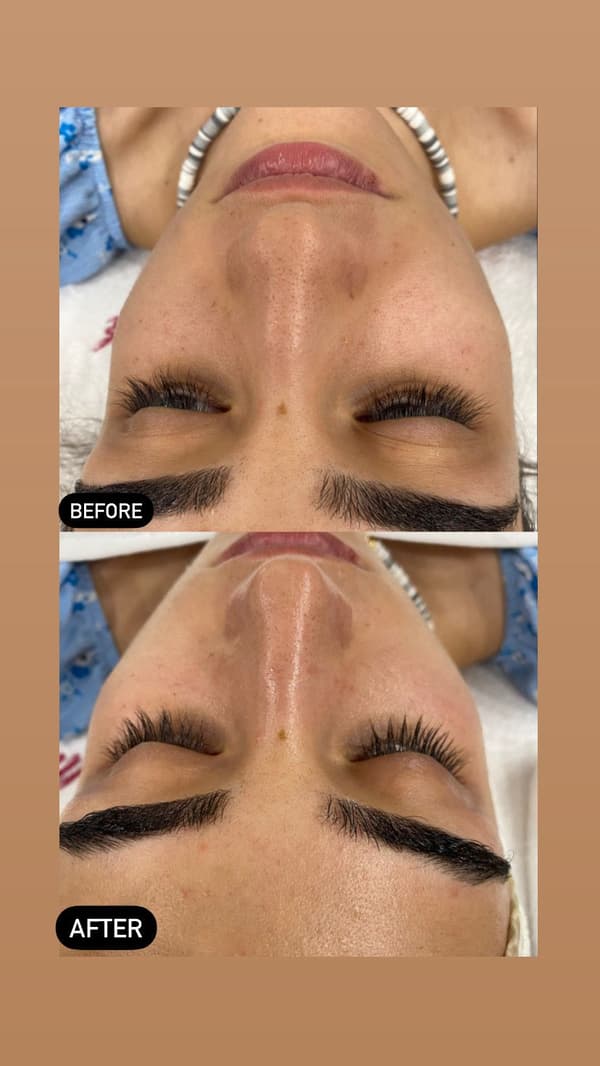 Sıla Zengin Güzellik Salonu - 178. Fotoğraf Sıla Zengin Güzellik Salonu - 178. Fotoğraf