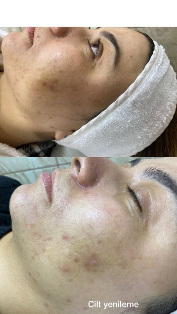 Sıla Zengin Güzellik Salonu - 84. Fotoğraf Sıla Zengin Güzellik Salonu - 84. Fotoğraf