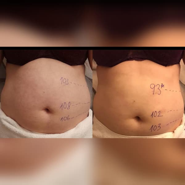 Ayşe Alya Güzellik Merkezi - 19. Fotoğraf Ayşe Alya Güzellik Merkezi - 19. Fotoğraf