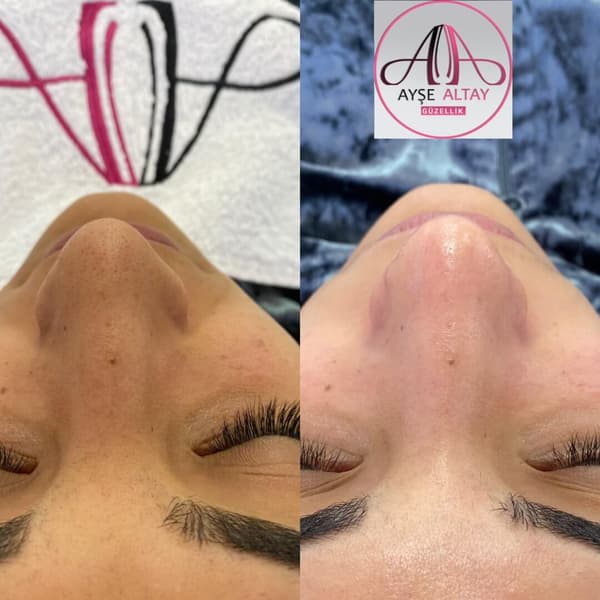 Ayşe Alya Güzellik Merkezi - 113. Fotoğraf Ayşe Alya Güzellik Merkezi - 113. Fotoğraf