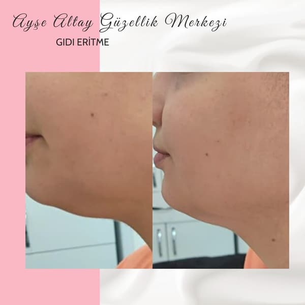 Ayşe Alya Güzellik Merkezi - 143. Fotoğraf Ayşe Alya Güzellik Merkezi - 143. Fotoğraf