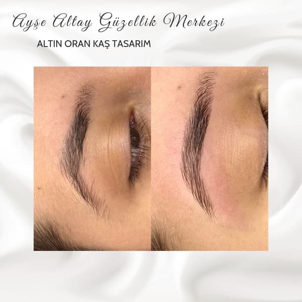 Ayşe Alya Güzellik Merkezi - 144. Fotoğraf Ayşe Alya Güzellik Merkezi - 144. Fotoğraf