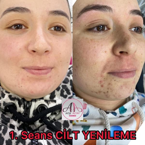 Ayşe Alya Güzellik Merkezi - 93. Fotoğraf Ayşe Alya Güzellik Merkezi - 93. Fotoğraf