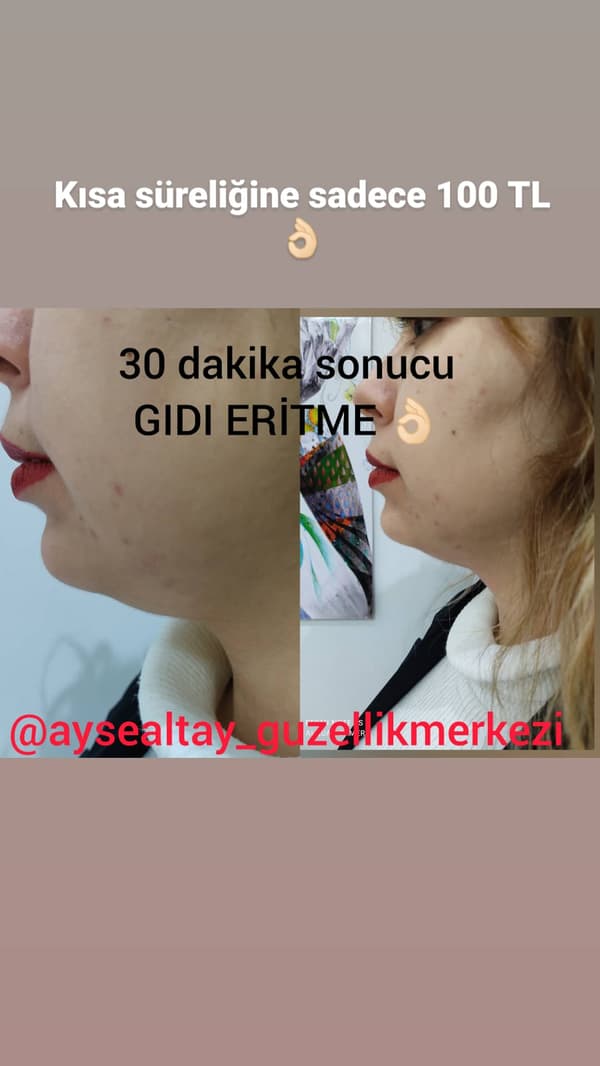 Ayşe Alya Güzellik Merkezi - 17. Fotoğraf Ayşe Alya Güzellik Merkezi - 17. Fotoğraf