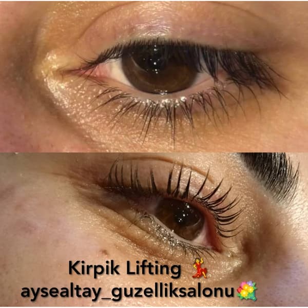 Ayşe Alya Güzellik Merkezi - 62. Fotoğraf Ayşe Alya Güzellik Merkezi - 62. Fotoğraf