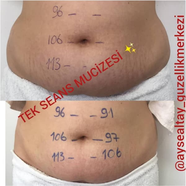 Ayşe Alya Güzellik Merkezi - 21. Fotoğraf Ayşe Alya Güzellik Merkezi - 21. Fotoğraf