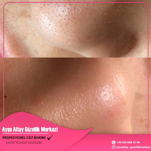 Ayşe Alya Güzellik Merkezi - 72. Fotoğraf Ayşe Alya Güzellik Merkezi - 72. Fotoğraf