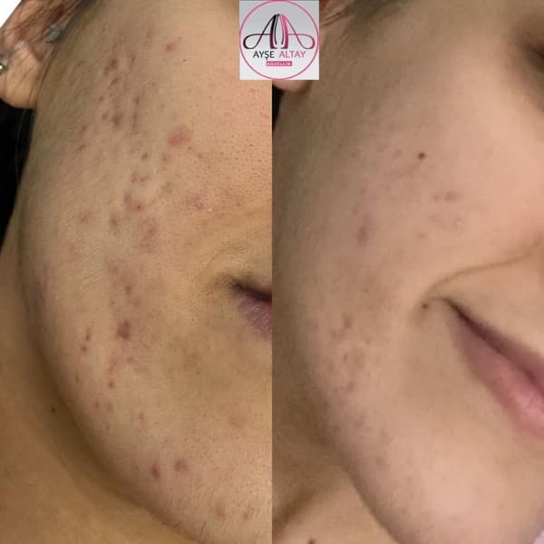 Ayşe Alya Güzellik Merkezi - 140. Fotoğraf Ayşe Alya Güzellik Merkezi - 140. Fotoğraf