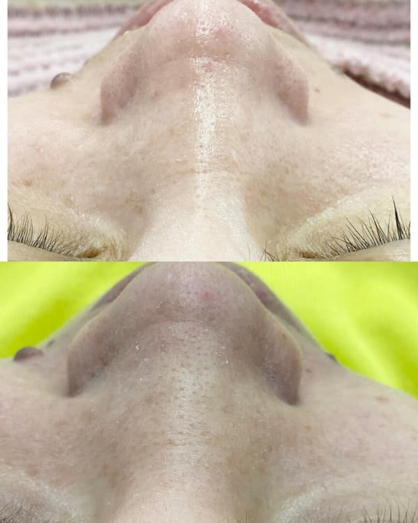 Ayşe Alya Güzellik Merkezi - 132. Fotoğraf Ayşe Alya Güzellik Merkezi - 132. Fotoğraf