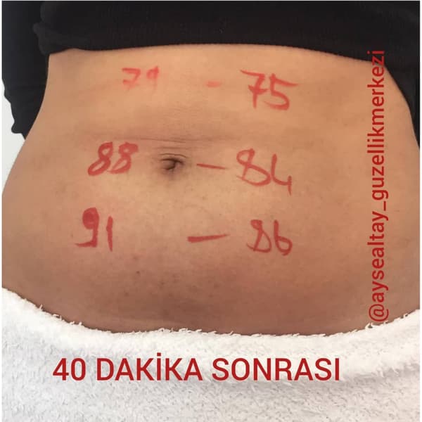 Ayşe Alya Güzellik Merkezi - 22. Fotoğraf Ayşe Alya Güzellik Merkezi - 22. Fotoğraf