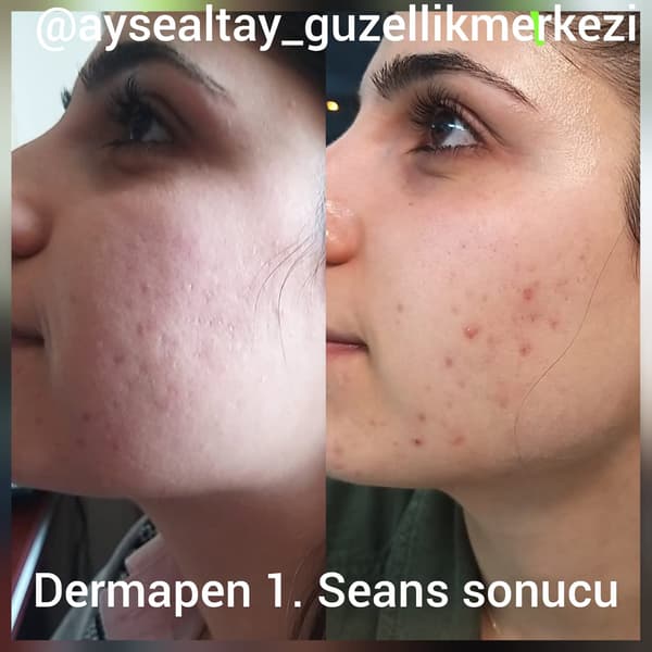 Ayşe Alya Güzellik Merkezi - 6. Fotoğraf Ayşe Alya Güzellik Merkezi - 6. Fotoğraf