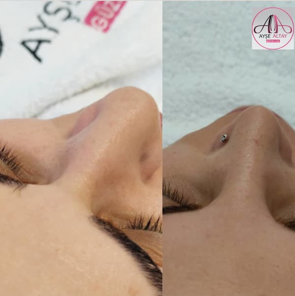 Ayşe Alya Güzellik Merkezi - 75. Fotoğraf Ayşe Alya Güzellik Merkezi - 75. Fotoğraf