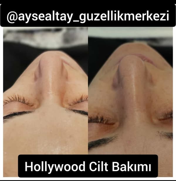 Ayşe Alya Güzellik Merkezi - 64. Fotoğraf Ayşe Alya Güzellik Merkezi - 64. Fotoğraf