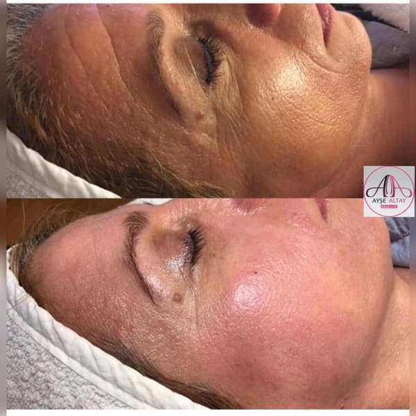 Ayşe Alya Güzellik Merkezi - 86. Fotoğraf Ayşe Alya Güzellik Merkezi - 86. Fotoğraf