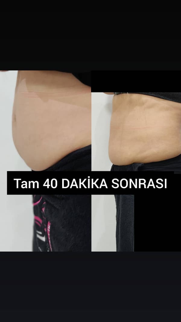 Ayşe Alya Güzellik Merkezi - 11. Fotoğraf Ayşe Alya Güzellik Merkezi - 11. Fotoğraf