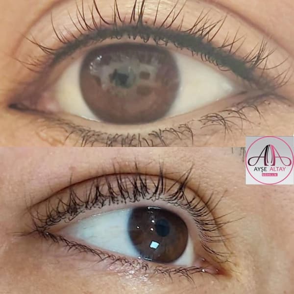 Ayşe Alya Güzellik Merkezi - 114. Fotoğraf Ayşe Alya Güzellik Merkezi - 114. Fotoğraf