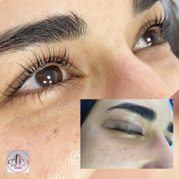 Ayşe Alya Güzellik Merkezi - 131. Fotoğraf Ayşe Alya Güzellik Merkezi - 131. Fotoğraf