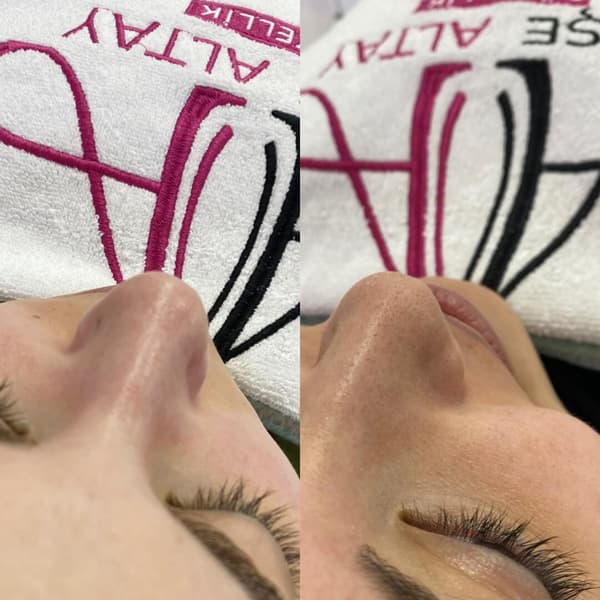 Ayşe Alya Güzellik Merkezi - 87. Fotoğraf Ayşe Alya Güzellik Merkezi - 87. Fotoğraf