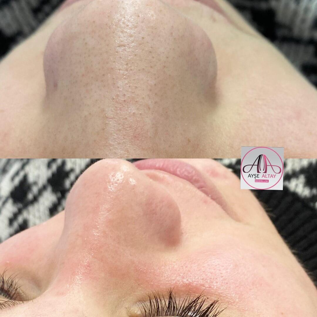 Ayşe Alya Güzellik Merkezi