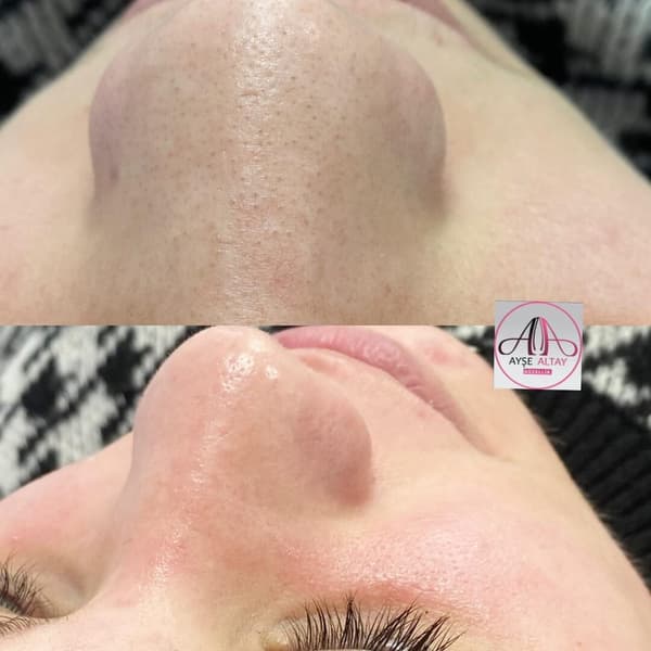 Ayşe Alya Güzellik Merkezi - 137. Fotoğraf Ayşe Alya Güzellik Merkezi - 137. Fotoğraf