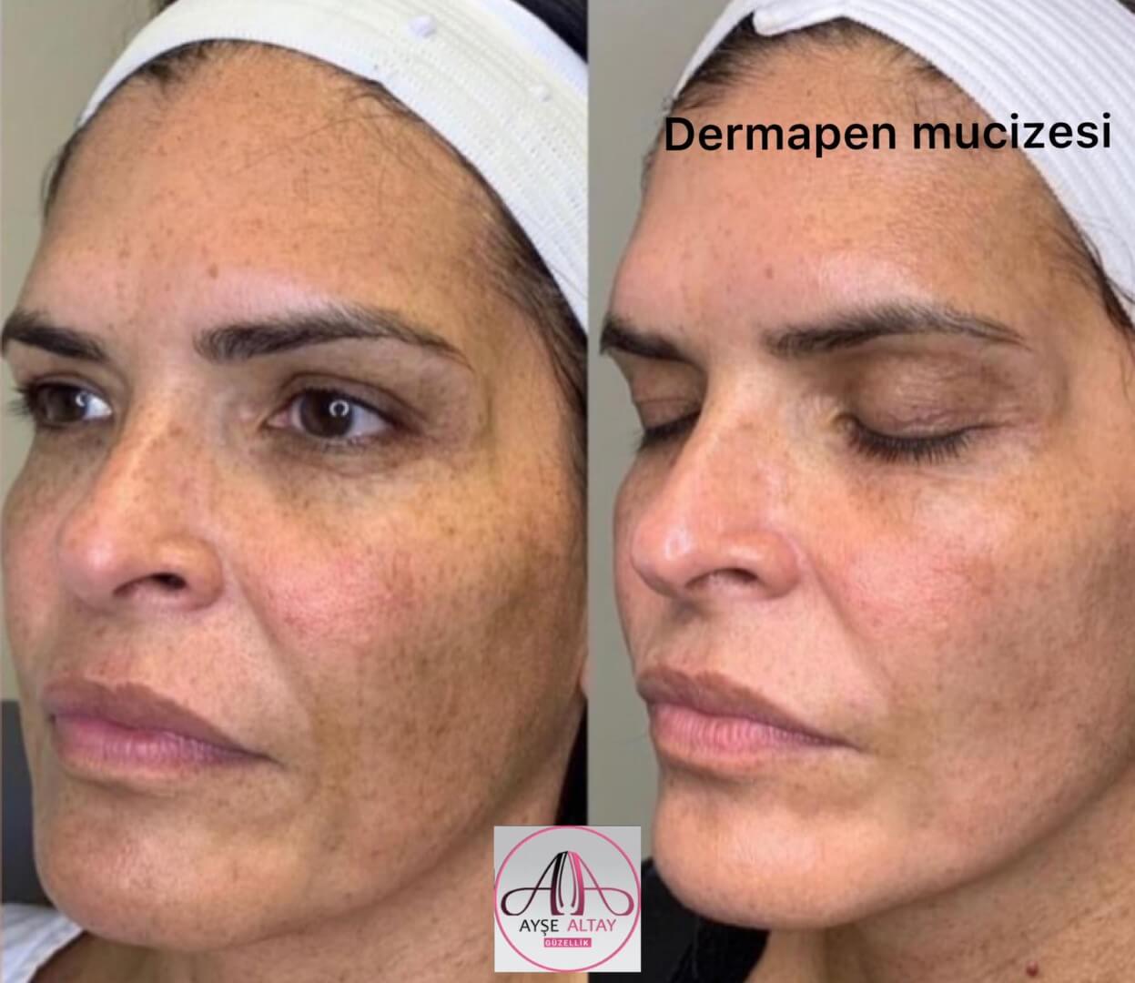 Ayşe Alya Güzellik Merkezi