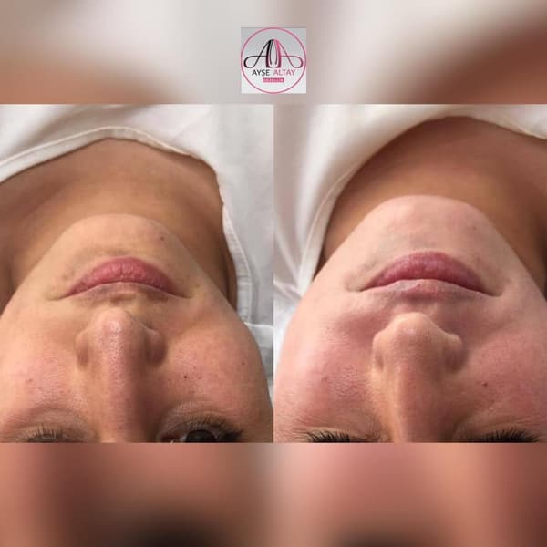 Ayşe Alya Güzellik Merkezi - 138. Fotoğraf Ayşe Alya Güzellik Merkezi - 138. Fotoğraf