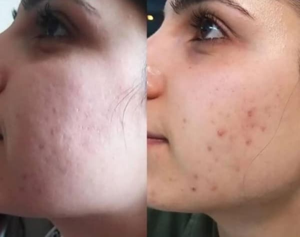 Ayşe Alya Güzellik Merkezi - 109. Fotoğraf Ayşe Alya Güzellik Merkezi - 109. Fotoğraf