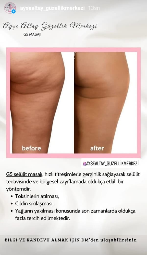 Ayşe Alya Güzellik Merkezi - 159. Fotoğraf Ayşe Alya Güzellik Merkezi - 159. Fotoğraf