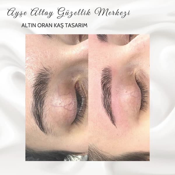 Ayşe Altay Güzellik Merkezi - 153. Fotoğraf