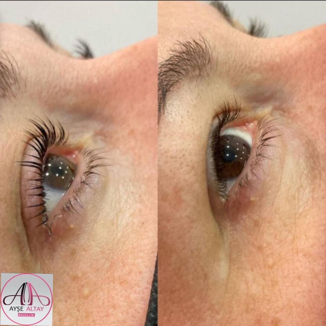 Ayşe Alya Güzellik Merkezi