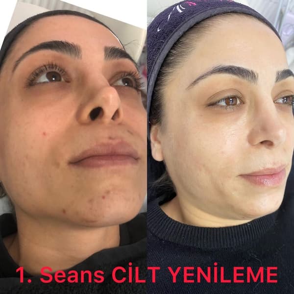 Ayşe Altay Güzellik Merkezi - 88. Fotoğraf