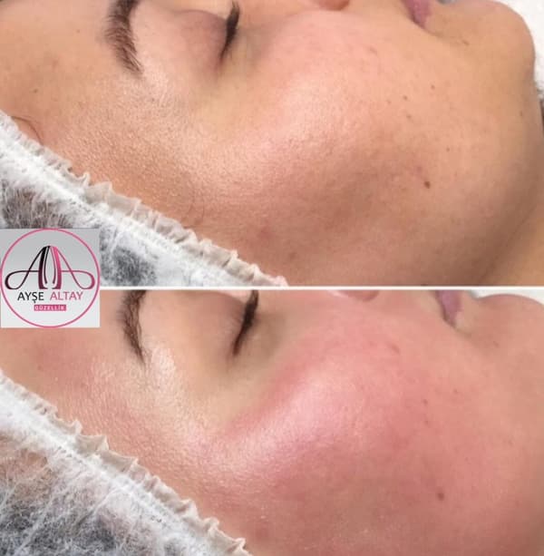Ayşe Alya Güzellik Merkezi - 80. Fotoğraf Ayşe Alya Güzellik Merkezi - 80. Fotoğraf