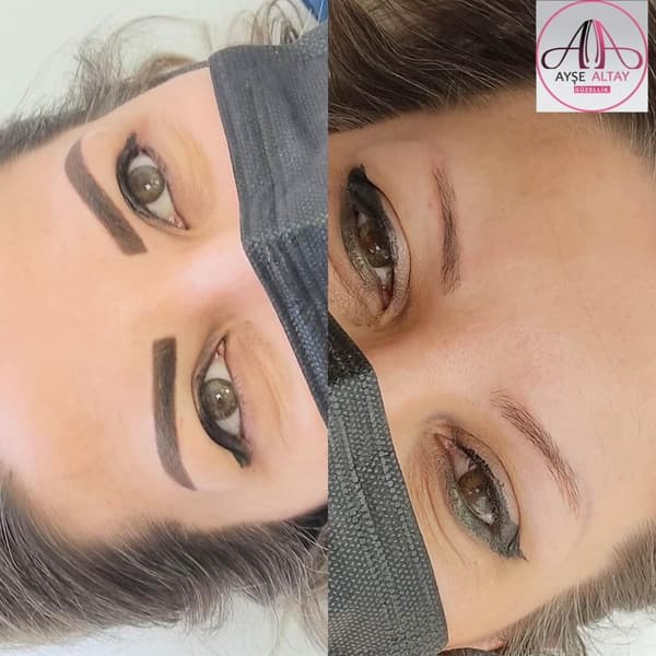 Ayşe Alya Güzellik Merkezi - 115. Fotoğraf Ayşe Alya Güzellik Merkezi - 115. Fotoğraf