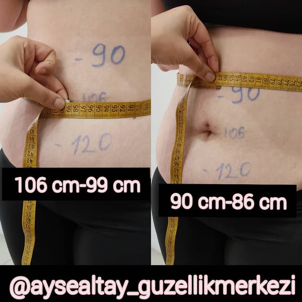 Ayşe Alya Güzellik Merkezi - 14. Fotoğraf Ayşe Alya Güzellik Merkezi - 14. Fotoğraf