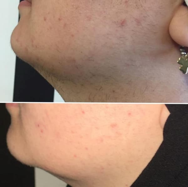 Ayşe Alya Güzellik Merkezi - 102. Fotoğraf Ayşe Alya Güzellik Merkezi - 102. Fotoğraf