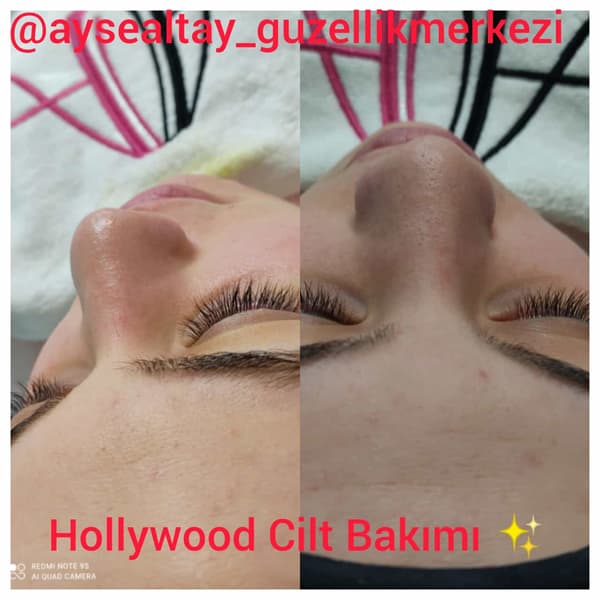 Ayşe Alya Güzellik Merkezi - 8. Fotoğraf Ayşe Alya Güzellik Merkezi - 8. Fotoğraf