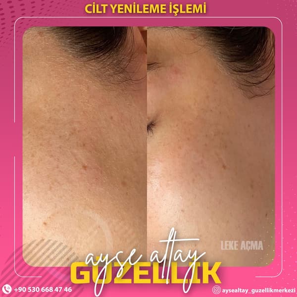 Ayşe Altay Güzellik Merkezi - 68. Fotoğraf
