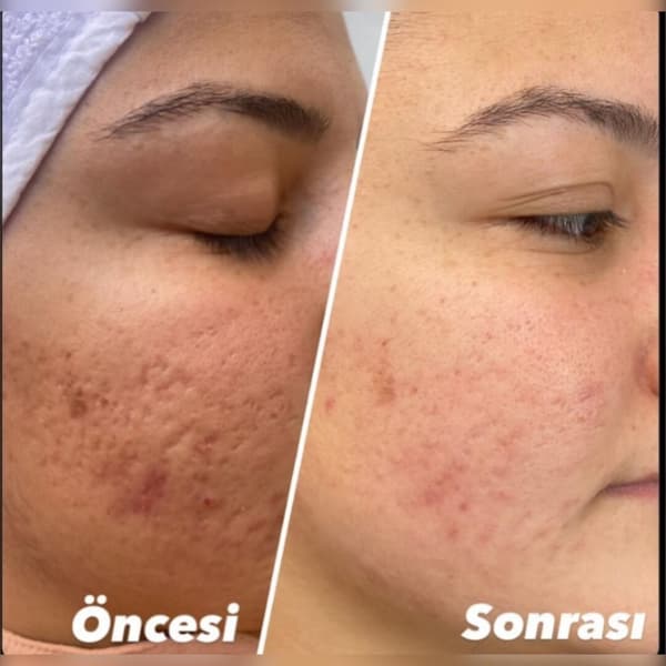 Ayşe Alya Güzellik Merkezi - 120. Fotoğraf Ayşe Alya Güzellik Merkezi - 120. Fotoğraf