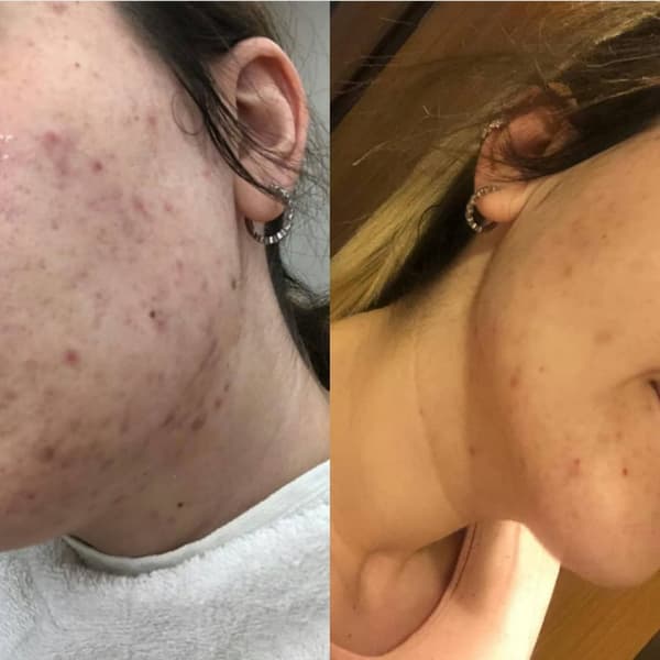 Ayşe Alya Güzellik Merkezi - 34. Fotoğraf Ayşe Alya Güzellik Merkezi - 34. Fotoğraf