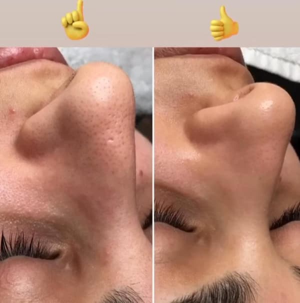 Ayşe Alya Güzellik Merkezi - 95. Fotoğraf Ayşe Alya Güzellik Merkezi - 95. Fotoğraf