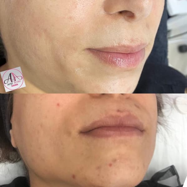 Ayşe Alya Güzellik Merkezi - 90. Fotoğraf Ayşe Alya Güzellik Merkezi - 90. Fotoğraf