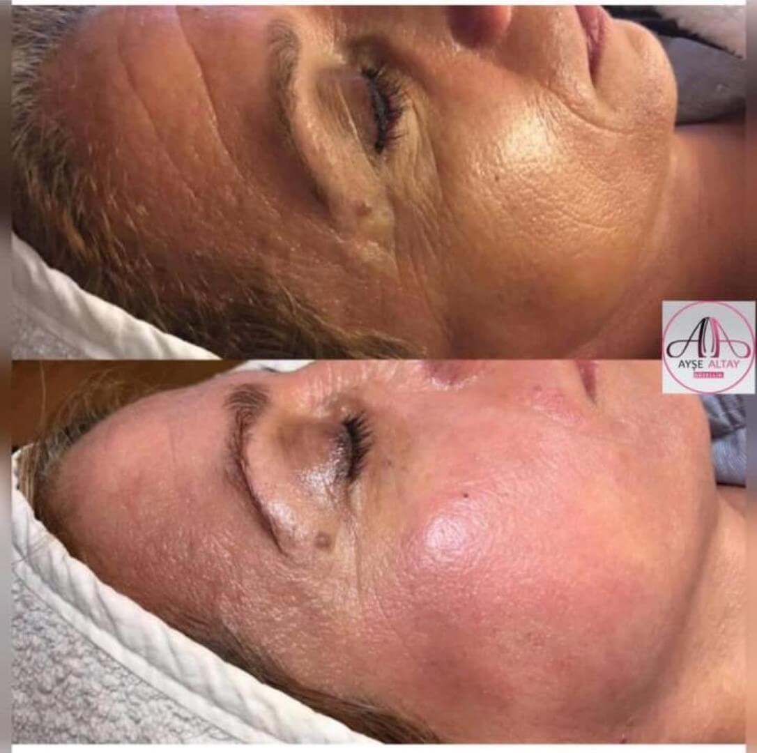 Ayşe Alya Güzellik Merkezi