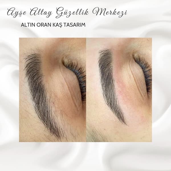 Ayşe Altay Güzellik Merkezi - 154. Fotoğraf