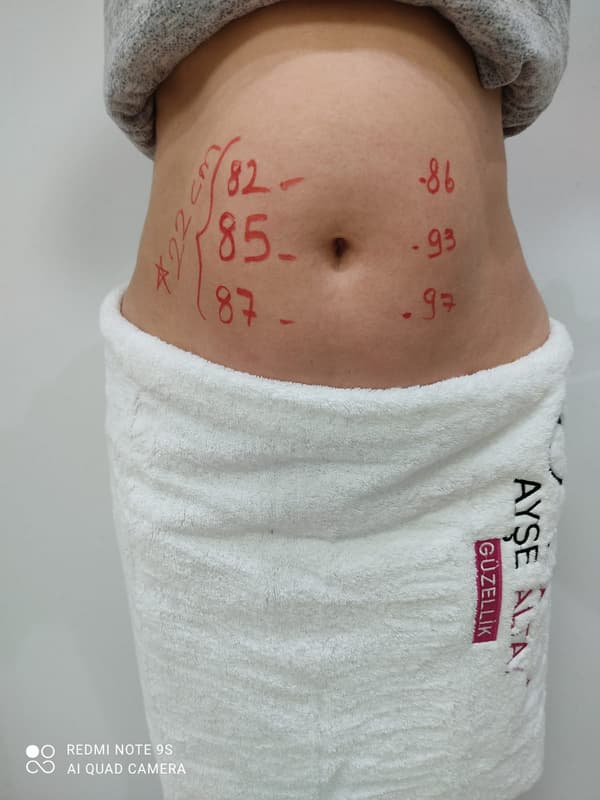 Ayşe Alya Güzellik Merkezi - 16. Fotoğraf Ayşe Alya Güzellik Merkezi - 16. Fotoğraf