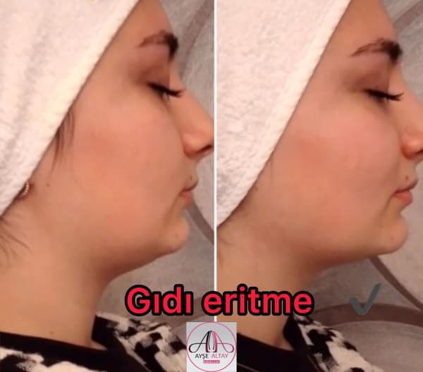 Ayşe Altay Güzellik Merkezi - 79. Fotoğraf