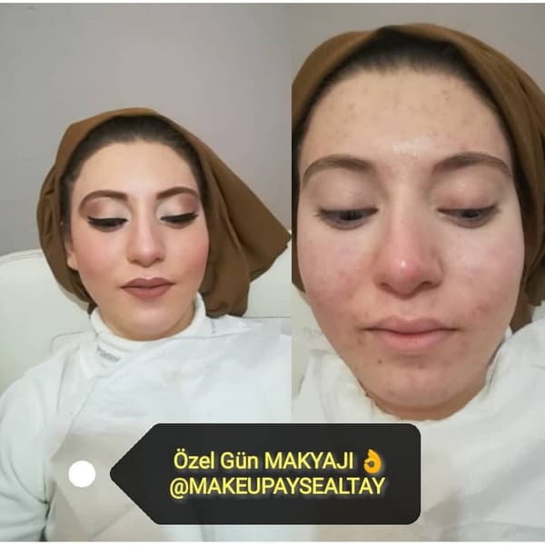 Ayşe Alya Güzellik Merkezi - 50. Fotoğraf Ayşe Alya Güzellik Merkezi - 50. Fotoğraf