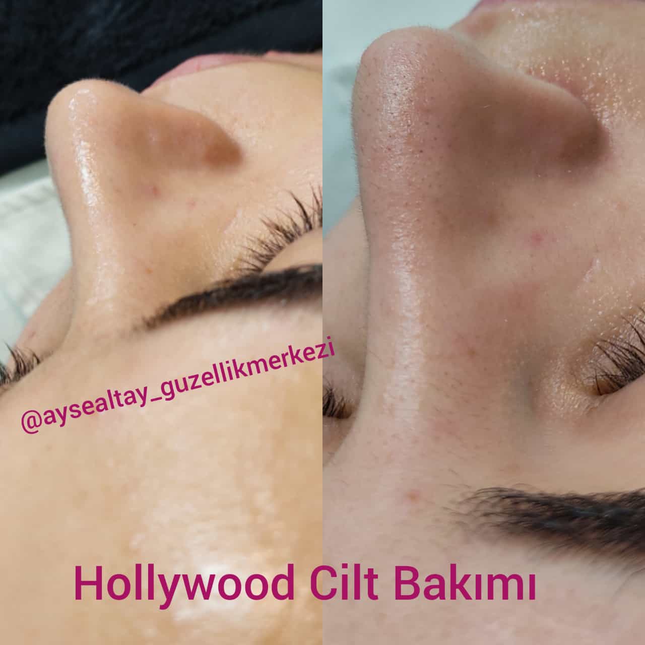 Ayşe Alya Güzellik Merkezi